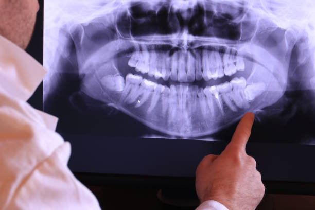Best Emergency Root Canal Treatment in Tehaleh, WA