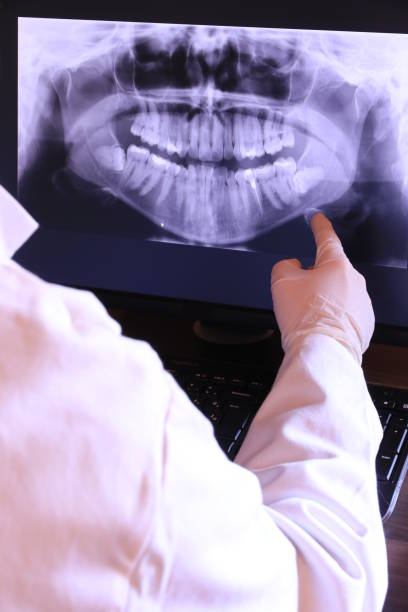 Best Emergency Gum Treatment in Tehaleh, WA