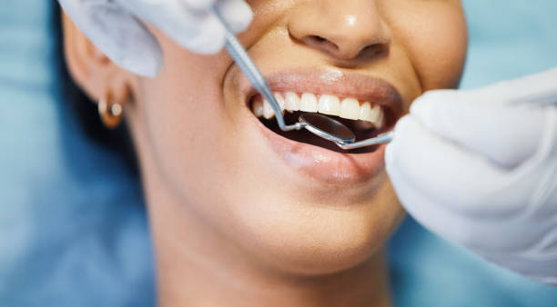 Best Weekend Emergency Dentist in Tehaleh, WA